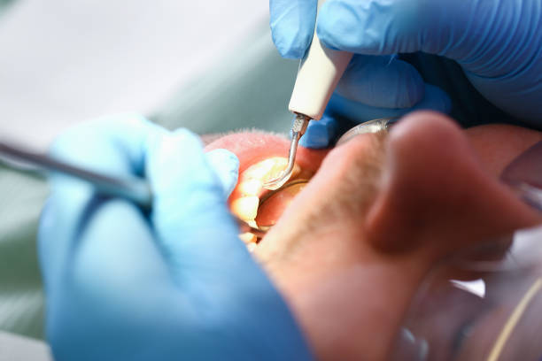 Best After-Hours Emergency Dentist in Norman Park, GA